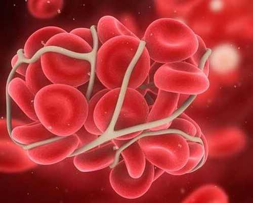 代孕一个大概多少钱_专家答疑 优生与备孕知识问