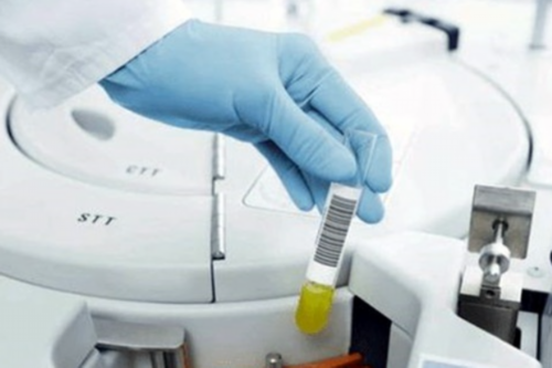 广东试管供卵流程-广东湛江供卵医院有哪几家？