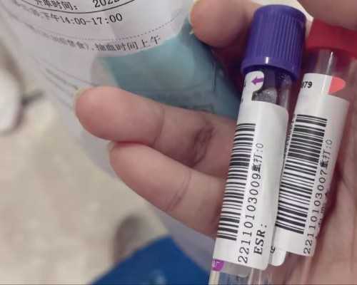 厦门供卵试管服务中心,厦门供卵试管婴儿医院排名？做试管哪个医院比较好？