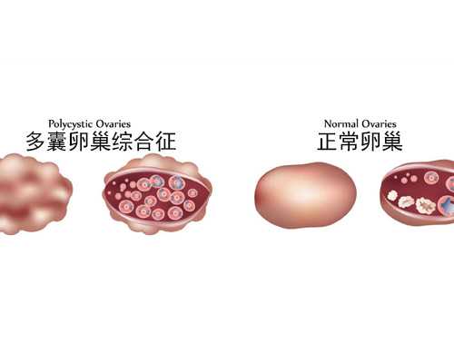 代孕的技术基础_代孕怎么上户口【代孕生子，实现宝宝来了】