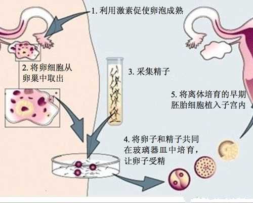深圳代孕二胎_深圳代孕合法化了吗_辅助生育前第一问-该选人工授精还是试管婴