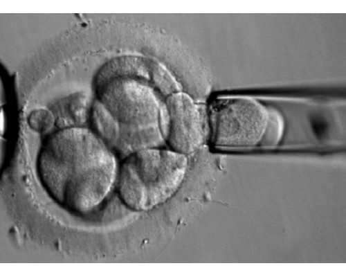深圳代孕妈妈的价钱_深圳找一个代孕网【行业代孕首选，专业放心】