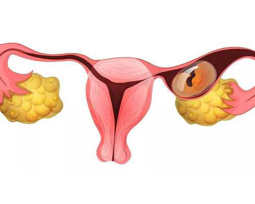深圳代生双胞胎包男孩_深圳专业试管代孕联系方
