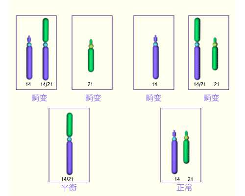 深圳代怀医院费用_女性不孕症的简易预防方法