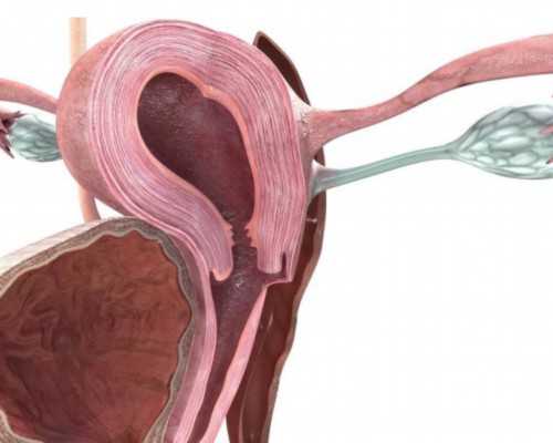 兰大二院成功实施一体位经腹全腹腔镜下上尿路尿路上皮癌根治术