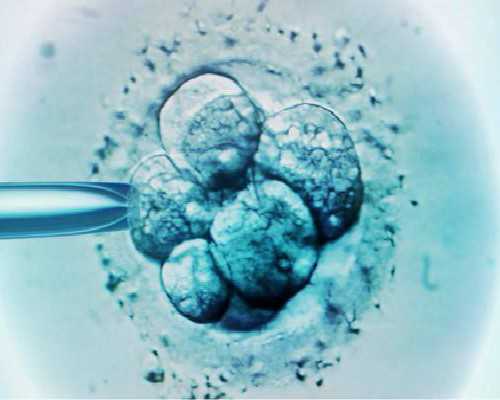 【乡土菜】豆瓣酸菜牛肉