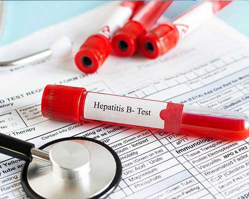 深圳专业代孕-深圳试管代孕筛选性别-前列腺炎怎么治疗？前列腺如何保健？