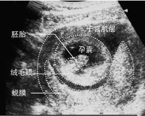 灵宝代孕多少钱_灵宝代孕是不是违法【灵宝代孕