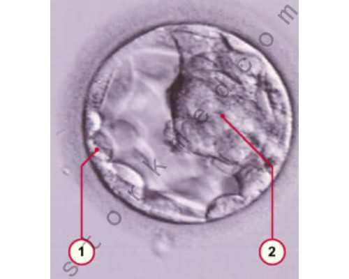 单身高龄女性可以做试管婴儿助孕吗?这些问题更应该考虑