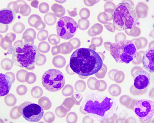 妇科分泌物检验报告单要怎么看