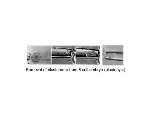 深圳供卵去哪里,【深圳哪里有供卵】结婚4年多，终于到等来我的狗崽