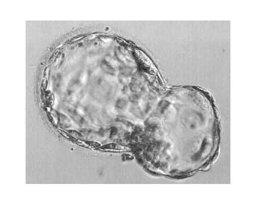 深圳做试管借卵子有皮肤病会遗传吗,深圳捐卵价
