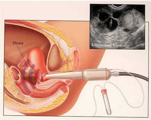 西囡医院能供卵吗,【西囡医院供卵试管】产检闯关怎一个忐忑了得，过一关心