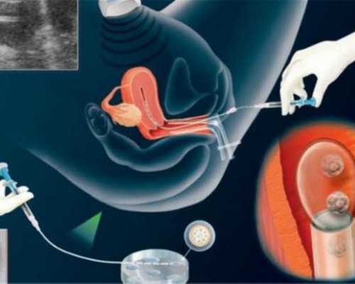 代孕妇前三个月能不能坐飞机