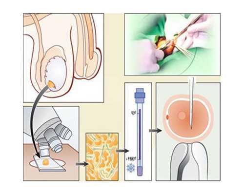 深圳代孕哪里最安全_自己流产了是不是宫外孕