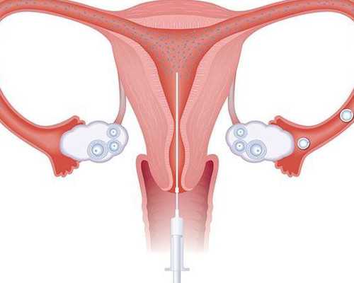 深圳代孕会不会违法,深圳代怀孕不孕咨询,高