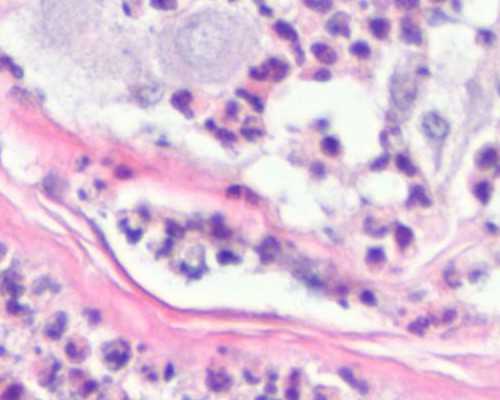 深圳代孕正规机构-深圳代孕产子费用问题-家用电子血压计哪种好