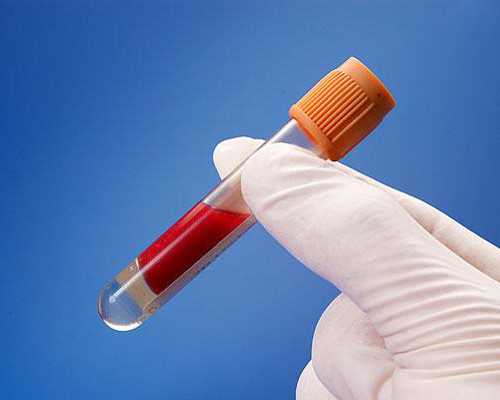 深圳最有名的试管婴儿排名「深圳试管排名前十名」