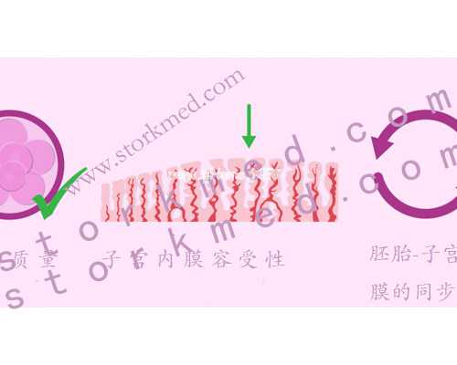 子宫腺肌症是什么呢-有哪些症状-