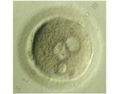 深圳有招代妈,深圳爱医集团13周年,邀请泰国试管医生yoko亲临深圳