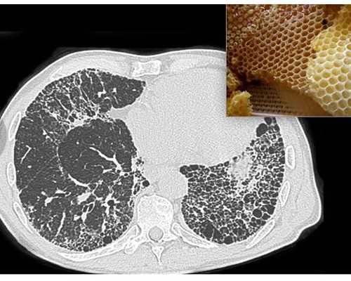 什么是代生-樱花校园模拟器冰雪奇缘中文版下载