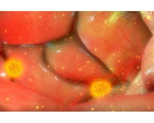 供卵试管生男孩要多少钱,泰国BNH医院供卵试管婴儿包生男孩多少钱