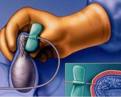 2026广东供卵试管多少钱?附最新供卵试管费用明细一览