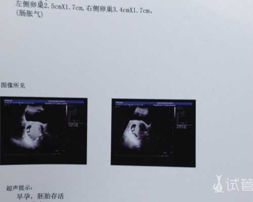 深圳代怀孕生殖中心，深圳生殖中心最好的医院排名前十