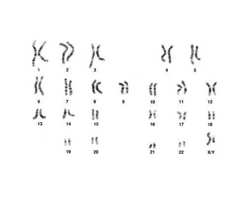 深圳最大供卵中介-深圳地下代孕市场-深圳那一家做代孕权威
