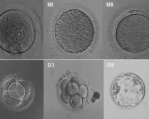 【免疫相关不良妊娠答疑解惑49】——遗传因素检查