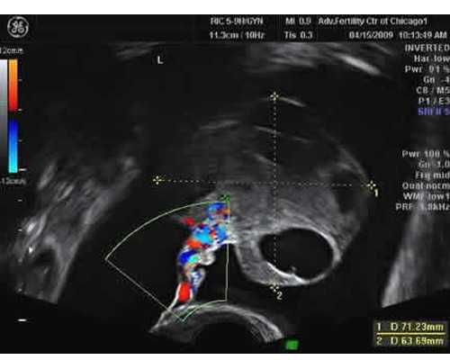 2026年深圳妇幼三代试管大概多少钱？