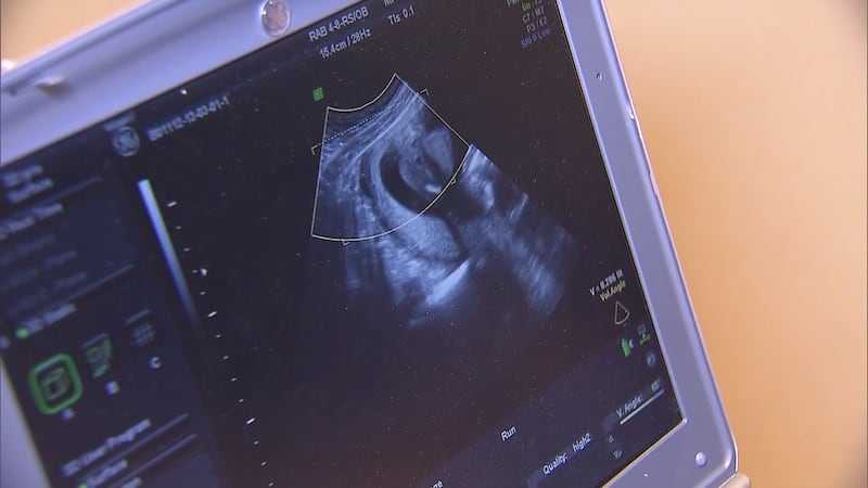 哈萨克斯坦代孕合法吗-别傻了！子宫肌瘤不是癌