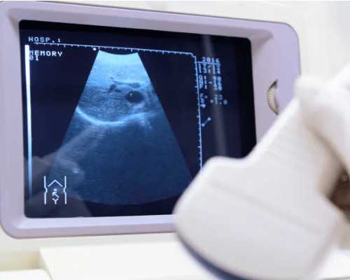 深圳哪有代孕-深圳代怀宝宝【深圳代孕行业首选，专业放心。】