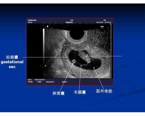 深圳代怀宝宝_助孕中心【专业代孕圆您求子心愿。】