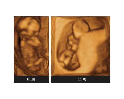 宁夏供卵价格一般多少,【深圳供卵流程 深圳供卵价格】说说自己的备孕两年半