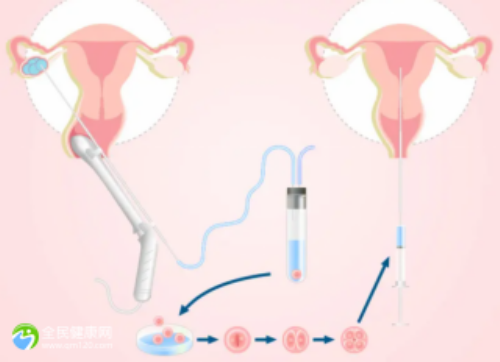 靓家居8+2客户体验触点升级，广东电视台DV现场卢俊宇亲自品控体验