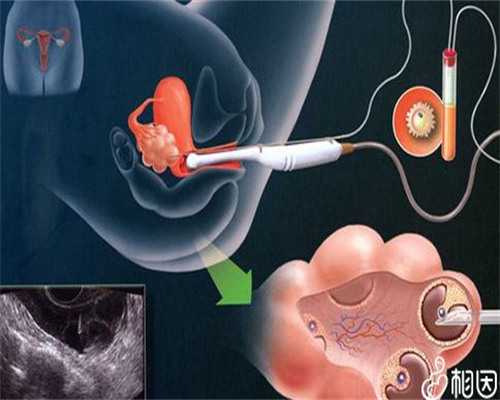 2026年南京能做供卵试管的医院有哪几家
