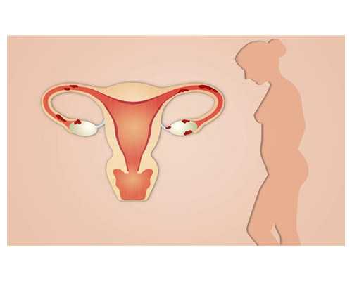 深圳代生子_深圳代孕生孩子价格_代孕30周是几个