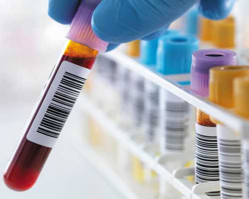 深圳供卵试管中心排行_怀孕吃什么都没有胃口怎