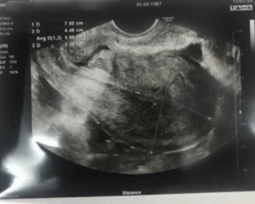 单位不执行产假规定最高罚五千专家称处罚低