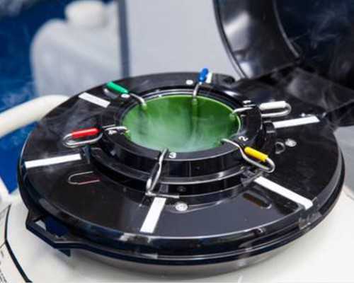 北京供卵试管公司哪家最靠谱，遗传性疾病可以供卵吗