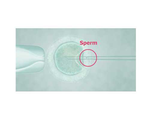 贵阳做单周期供卵试管大概需要准备多少钱？