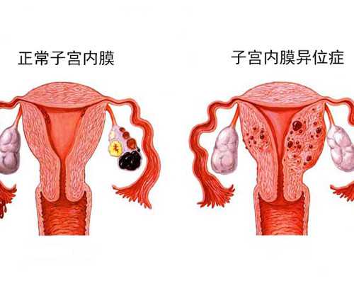 深圳代孕机构_深圳代孕套餐_深圳代孕包性别多少钱