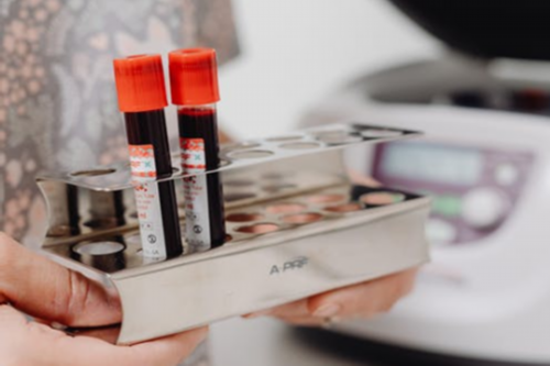 荆门代生男孩多少钱,女性不孕应做哪些检查