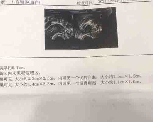 男性死精症由哪些原因引起