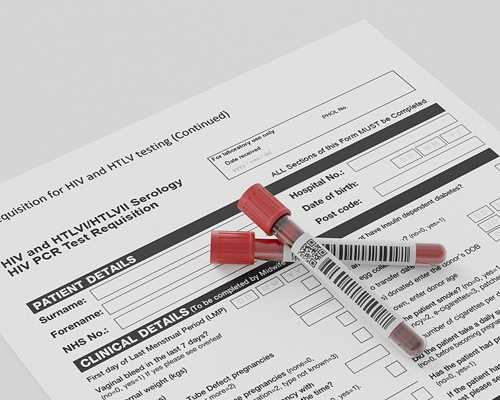 试管婴儿移植后症状！小心胚胎流掉！