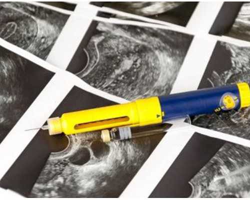 深圳专业代孕_深圳代孕多少费用_深圳国内哪里找代妈