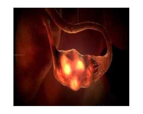 满洲里代孕-满洲里如何寻找代孕-满洲里代孕包成