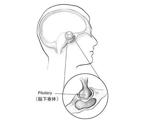 怀孕后内裤上有黄渍什么情况