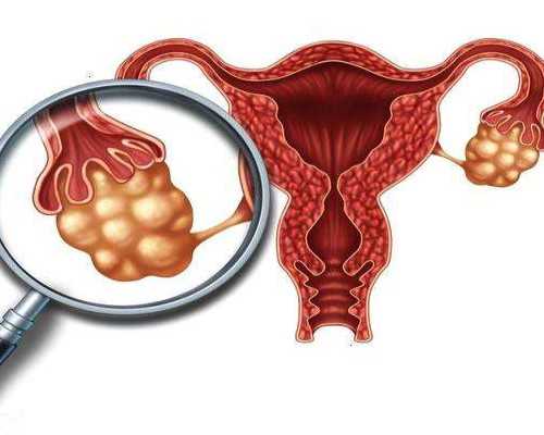 深圳哪里做代孕-深圳非中介代生孩子qq群【从客户出发，提供超值代孕服务】